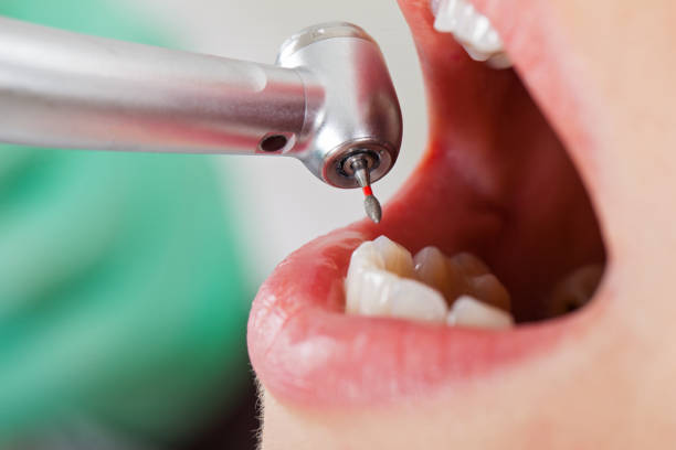 Best Broken or Cracked Tooth Emergency Dentist in Louisville, NE